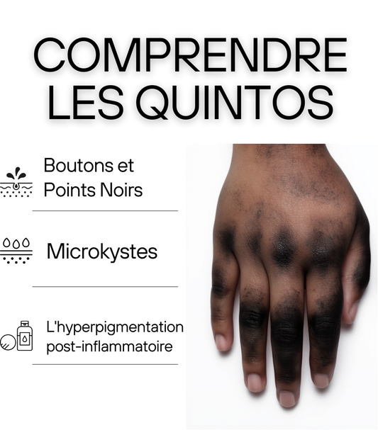 Dites Adieu aux Quintos : Le Sérum Révolutionnaire de Michèle Care pour une Peau Impeccable