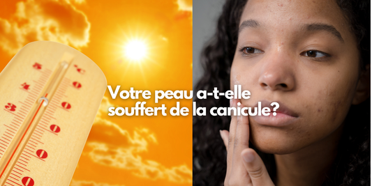 Votre peau a-t-elle souffert de la canicule ?